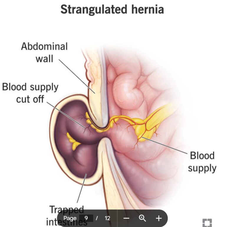 Top general surgeons in Kurnool for hernia