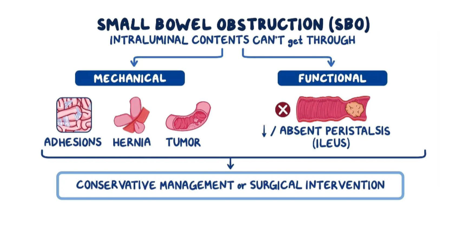 Laparoscopic hernia surgery near me